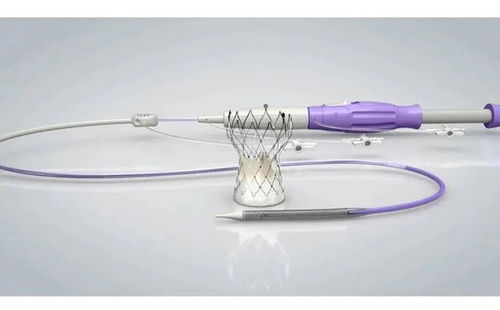 2021年園區5款創新醫療器械產品獲批上市，占全省71%